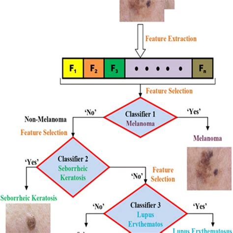 Block Diagram Of Proposed Skin Disease Classification Download