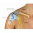 Shoulder Dislocation  What You Need To Know As A Patient