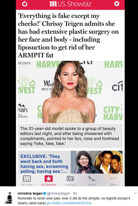 Chrissy Teigen Reveals She Once Had Fat Sucked Out Of Her Armpits Clarifies Face Surgery Story