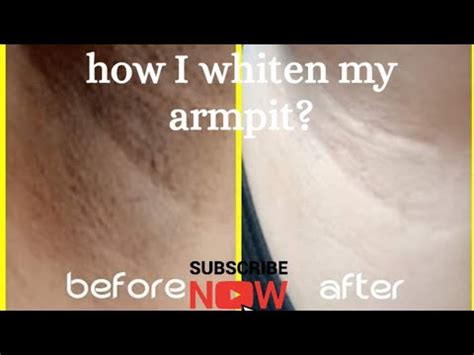 How To Whiten Your Armpit Tips To Make It Smells Good Youtube