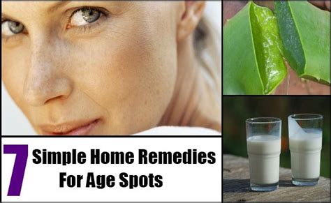 7 Simple Home Remedies For Age Spots Age Spot Remedies Age Spots