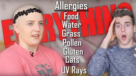 Meet The Girl Whos Allergic To Everything Youtube