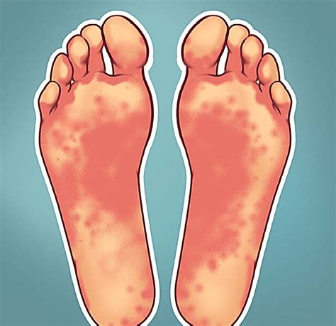This Is What Your Feet Reveal About Your Health