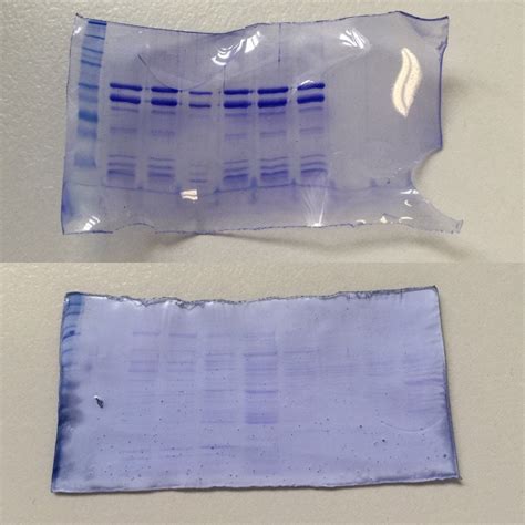 We Have Two Different Protocols For Saving Sds Page Gels In Our Lab