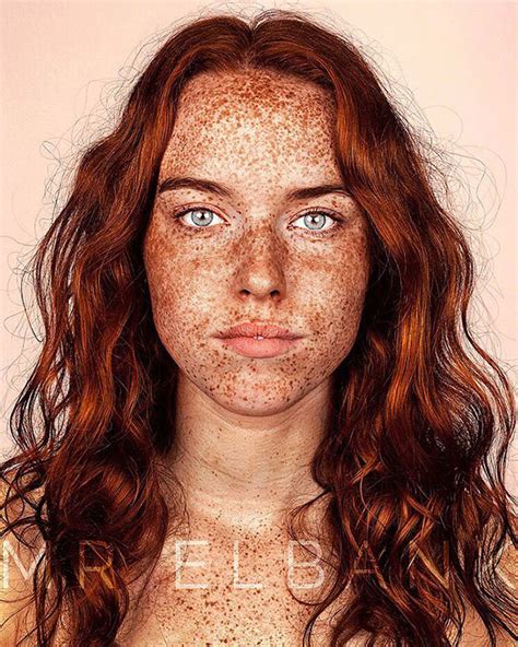 Unique Beauty Of Freckled People Documented By Brock Elbank