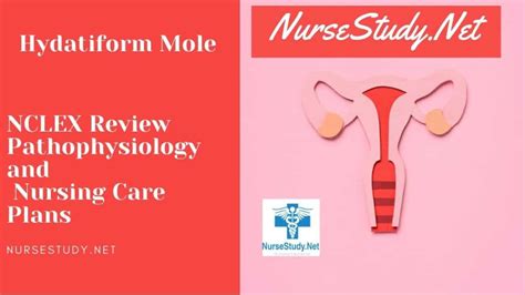 Hydatidiform Mole Nursing Diagnosis Interventions And Care Plans