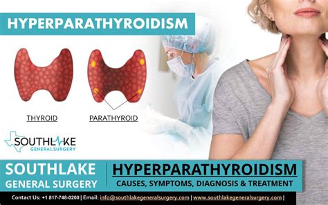 Hyperparathyroidism Causes Symptoms Diagnosis Treatment