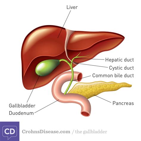 Gallstones Crohn S Disease Inflammatoryboweldisease Net