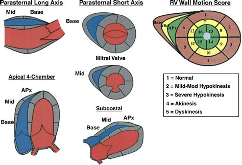 Role Of Right Ventricular Wall Motion Abnormalities In Risk
