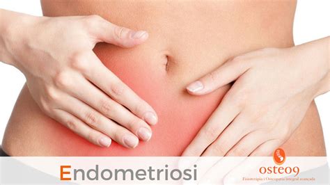Il tessuto endometriale che si. Osteo9 Endometriosi - part I