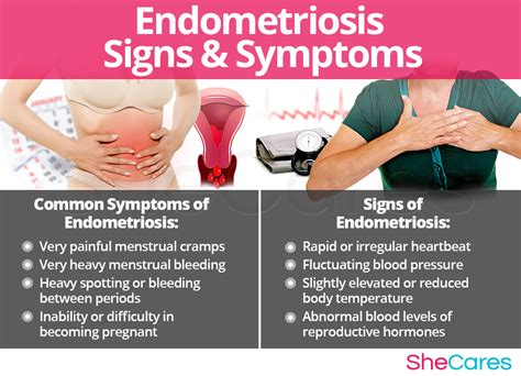 Endometriosis Symptoms Endometriosis Basics Pelvic Pt Carolina Pelvic