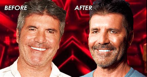 Agt Fans Shook Is Simon Cowells New Face Due To Vegan Diet Or Botox