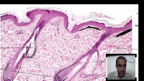 Histology Of Integumentary System Thick Skin Thin Skin Youtube