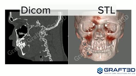 capabilities of d2p dicom to print software youtube