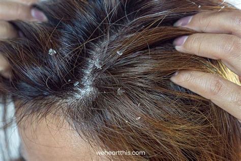 Hair Buildup What It Is The Easiest Way To Remove It