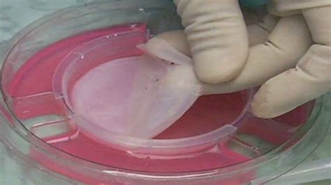 Lab Created Skin Helps Wounds Heal