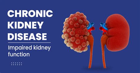 Chronic Kidney Disease Symptoms Risk Factors And More