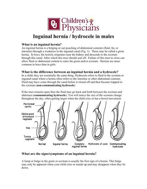 Inguinal Hernia Hydrocele In Males Ou Medicine