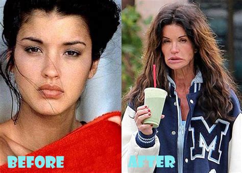 Janice Dickinson Plastic Surgery Before And After Lovely Surgery