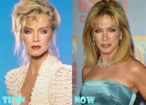Doona bae was born in seoul, south korea. Donna Mills Plastic Surgery Botox, Facelift Before and ...