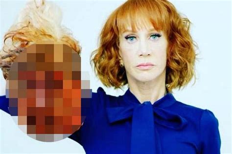 Kathy griffin revealed she has lung cancer despite never smoking and said she'll be undergoing surgery to remove half her lung. Kathy Griffin continúa perdiendo trabajos por foto con ...