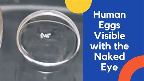 Human Eggs Visible With The Naked Eyes An Injection Without Pain Youtube
