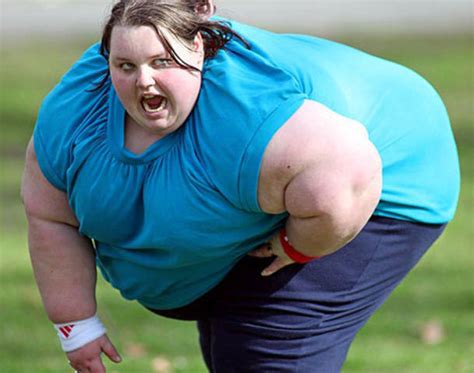 Bodies Deformed By Obesity Interesting Pictures