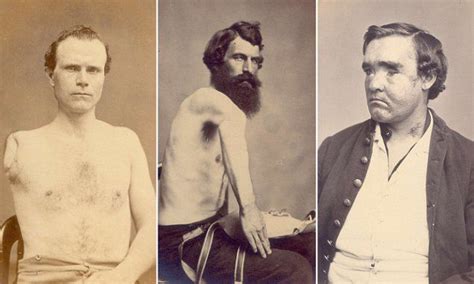 haunting portraits of civil war soldiers horrifically maimed cdv s soldiers pinterest