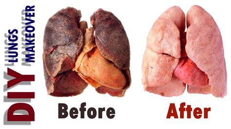 What foods do you like? Clean your lungs in just 72 hours! | iMalayalee ...