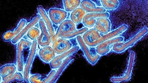 Gripe é uma doença infecciosa causada por diversos vírus arn da família orthomyxoviridae e que afeta aves e mamíferos.os sintomas mais comuns são calafrios, febre, rinorreia, dores de garganta, dores musculares, dores de cabeça, tosse, fadiga e sensação geral de desconforto. Estos son los 10 virus más peligrosos del mundo - LA ...