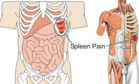Learn about the common causes of pain under left rib cage, what you can do to relieve the pain and when to seek medical advice quickly. Are The Kidneys Located Inside Of The Rib Cage : The ...