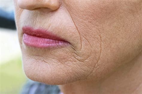 The 5 Types Of Skin Aging And How To Identify Them