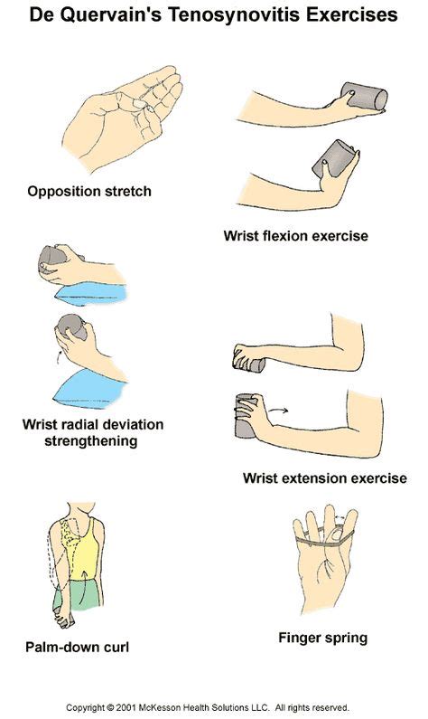 De Quervain S Tenosynovitis Exercises Illustration Physical Therapy