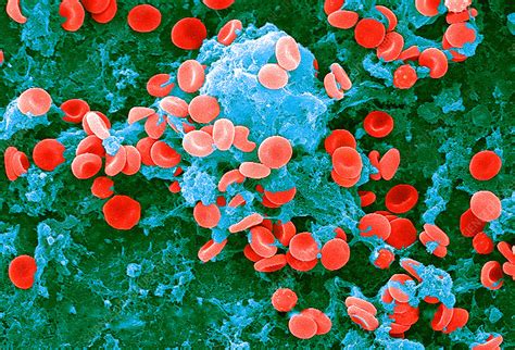 Red Blood Cells Sem Stock Image C0174172 Science Photo Library