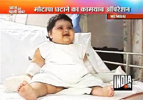 Breach Candy Surgeons Perform Surgery On Month Girl Weighing Kg National News India TV