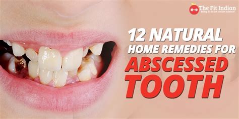 12 Natural Home Remedies For Abscessed Tooth Tips To Avoid The Condition