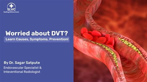 Deep Vein Thrombosis Dvt How It Occurs Symptoms Diagnosis And