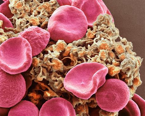 Red Blood Cells And Platelets Photograph By Steve Gschmeissner Pixels