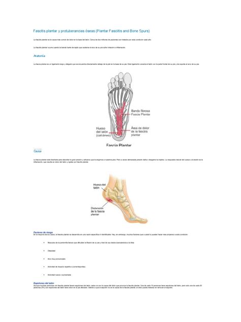 Fascitis Plantar