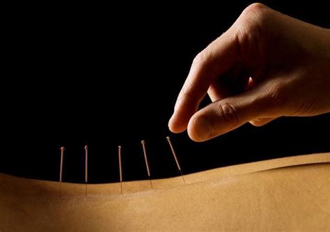 Rygestop Med Akupunktur Virker Det Og Hvad Koster Det