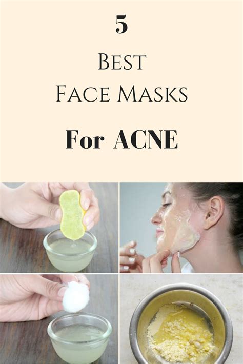 5 Best Face Masks For Acne That Will Remove All Acnepimples From Your