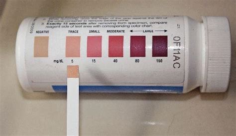 5 those on the keto diet also had significant improvements in blood pressure, body weight, and other markers of metabolic syndrome. What are ketosis strips and where can you buy them? - Quora
