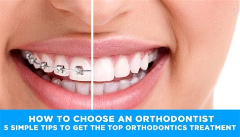 How To Choose An Orthodontist — 5 Simple Tips To Get The Top Orthodontics Treatment By Jessica