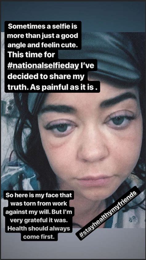 Sarah Hyland Takes A Real Selfie The Blemish