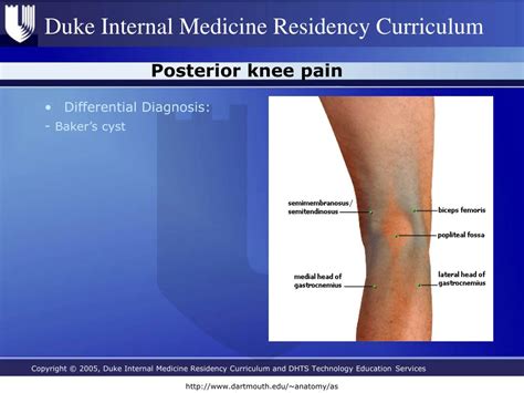 Ppt Knee Pain Powerpoint Presentation Free Download Id4778048