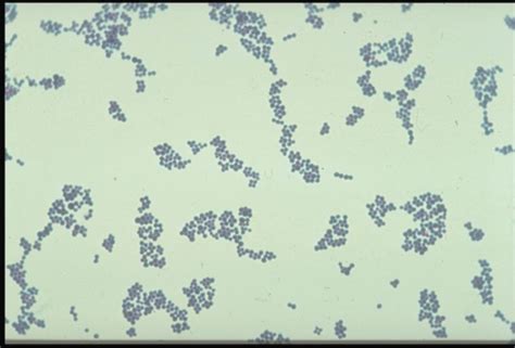 Gram Positive Cocci Of Medical Importance Flashcards Quizlet