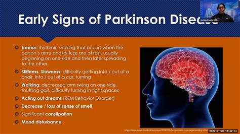 Get The Facts About Parkinsons Disease Free Webinar Youtube