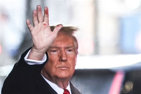 Donald Trumps Red Spotted Hand In Photo Sparks Speculation