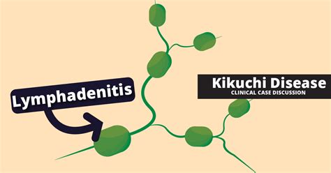 Kikuchi Fujimoto Disease Kfd Clinical Case Discussion Tiny Medicine
