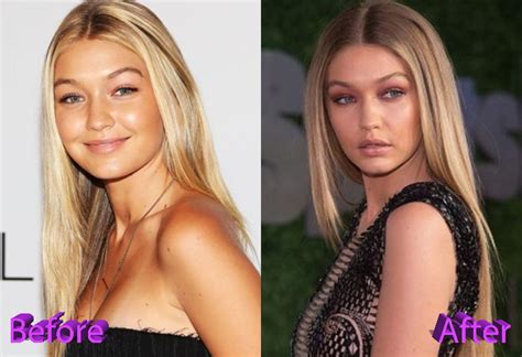 Gigi hadid spotted in ny after leaving maybelline photoshoot. Gigi Hadid Plastic Surgery: Looking Better Than Ever